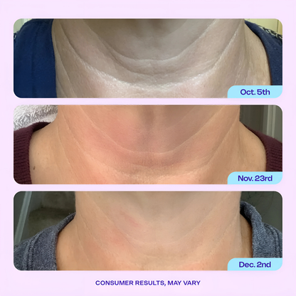 Slivra™ NeckLift Cream